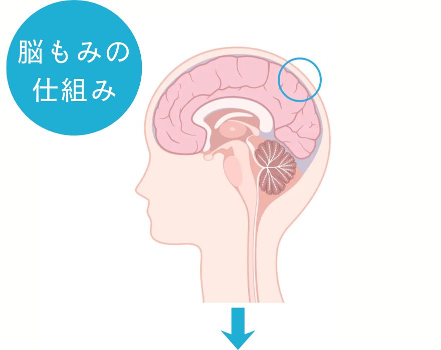 脳もみの仕組みについて